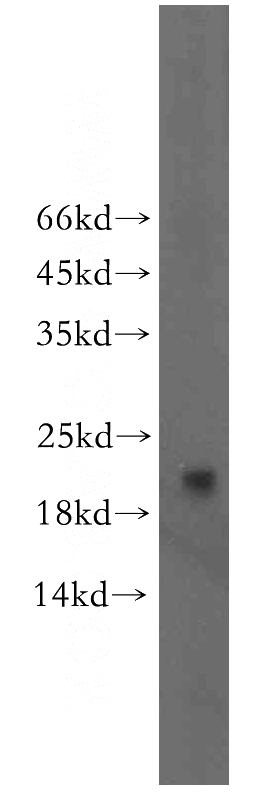 human liver tissue were subjected to SDS PAGE followed by western blot with Catalog No:113135(NRTN-Specific antibody) at dilution of 1:400
