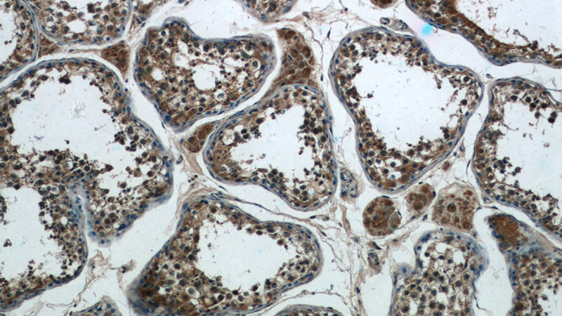 Immunohistochemistry of paraffin-embedded human testis tissue slide using Catalog No:116856(WDR16 Antibody) at dilution of 1:50 (under 10x lens)