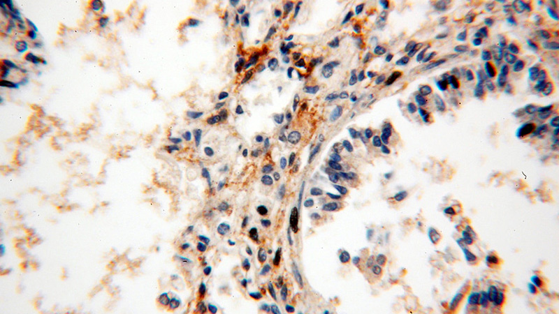 Immunohistochemical of paraffin-embedded human lung using Catalog No:108665(C14orf94 antibody) at dilution of 1:100 (under 40x lens)