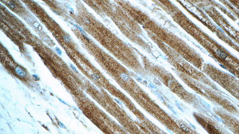 Immunohistochemistry of paraffin-embedded human heart tissue slide using Catalog No:112548(MCHR1 Antibody) at dilution of 1:50 (under 40x lens)