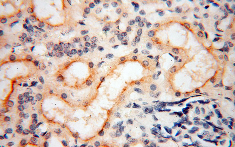 Immunohistochemical of paraffin-embedded human kidney using Catalog No:112267(LAD1 antibody) at dilution of 1:100 (under 40x lens)