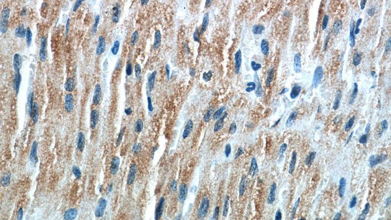 Immunohistochemical of paraffin-embedded human heart using Catalog No:116322(TRIM63 antibody) at dilution of 1:50 (under 40x lens)