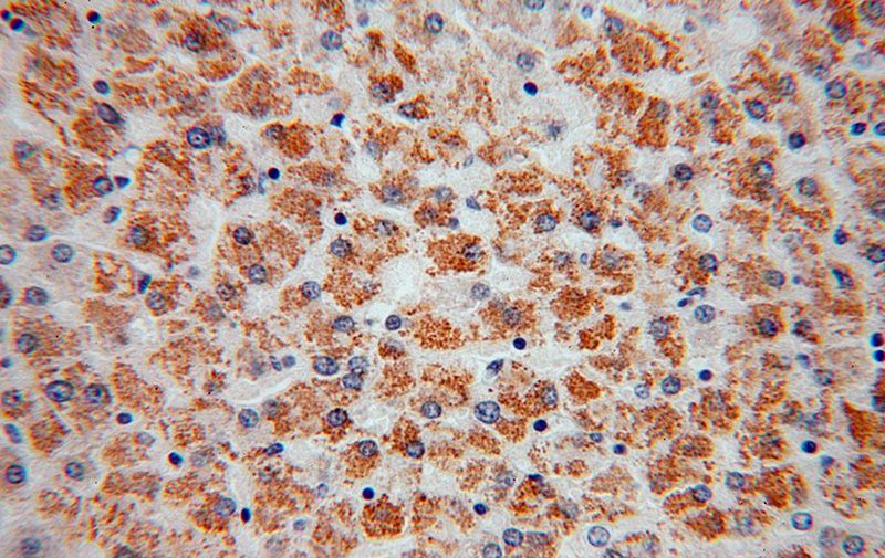 Immunohistochemical of paraffin-embedded human liver using Catalog No:108322(ATPB antibody) at dilution of 1:100 (under 40x lens)