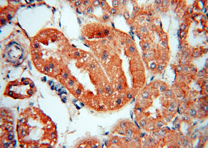 Immunohistochemical of paraffin-embedded human kidney using Catalog No:116346(TRAPPC9,NIBP antibody) at dilution of 1:50 (under 40x lens)
