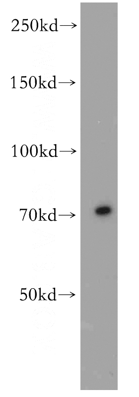 BxPC-3 cells were subjected to SDS PAGE followed by western blot with Catalog No:116316(TRIM41 antibody) at dilution of 1:800