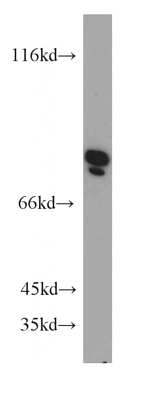 HepG2 cells were subjected to SDS PAGE followed by western blot with Catalog No:109440(COL8A1 antibody) at dilution of 1:500