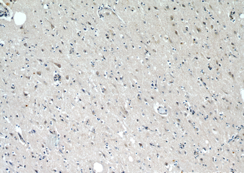 Immunohistochemical of paraffin-embedded human brain using Catalog No:113536(DCTN1 antibody) at dilution of 1:50 (under 10x lens)