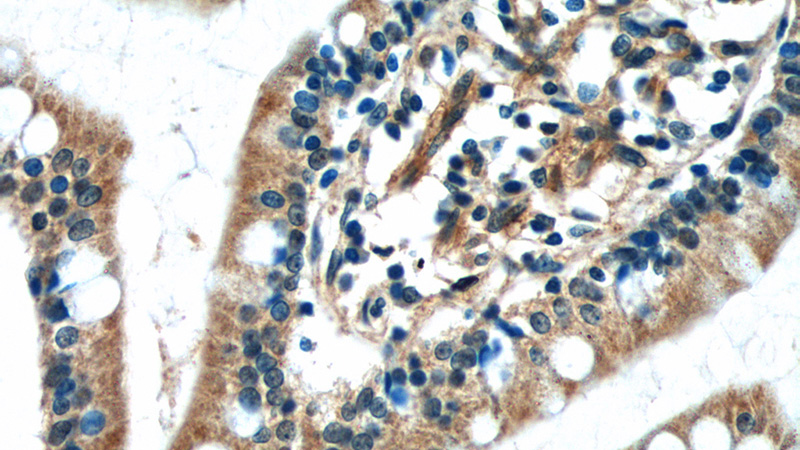 Immunohistochemistry of paraffin-embedded human small intestine tissue slide using Catalog No:108713(C2orf47 Antibody) at dilution of 1:50 (under 40x lens)