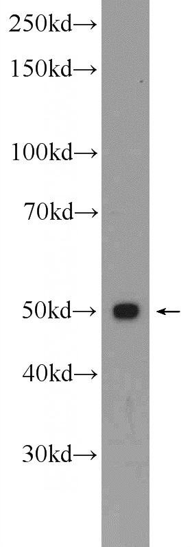 Jurkat cells were subjected to SDS PAGE followed by western blot with Catalog No:115120(SEPT6 Antibody) at dilution of 1:600