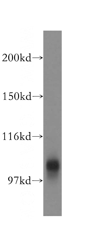 mouse lung tissue were subjected to SDS PAGE followed by western blot with Catalog No:107915(AGBL2 antibody) at dilution of 1:500