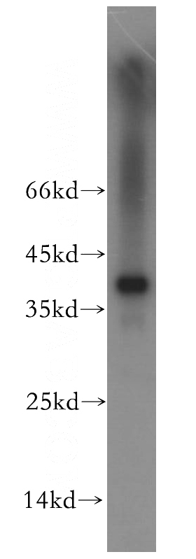 mouse liver tissue were subjected to SDS PAGE followed by western blot with Catalog No:116217(TPSAB1 antibody) at dilution of 1:800
