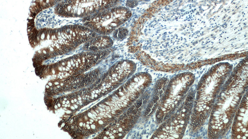 Immunohistochemistry of paraffin-embedded human colon tissue slide using Catalog No:108774(CDH17 Antibody) at dilution of 1:200 (under 10x lens)