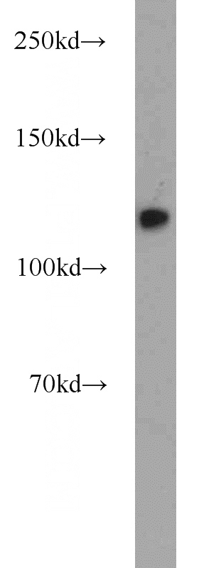 K-562 cells were subjected to SDS PAGE followed by western blot with Catalog No:112552(MCM2 antibody) at dilution of 1:1000