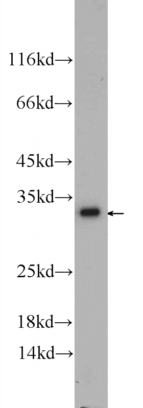 L02 cells were subjected to SDS PAGE followed by western blot with Catalog No:115339(SLC25A6-Specific antibody) at dilution of 1:500