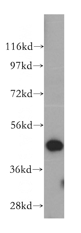 Jurkat cells were subjected to SDS PAGE followed by western blot with Catalog No:115483(SNX5 antibody) at dilution of 1:500