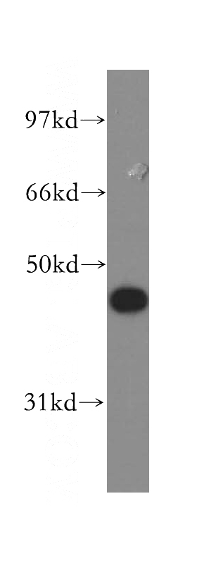 Jurkat cells were subjected to SDS PAGE followed by western blot with Catalog No:110837(LGALS4,GAL4 antibody) at dilution of 1:400