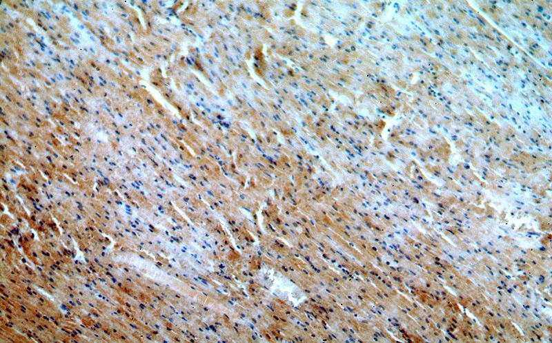 Immunohistochemical of paraffin-embedded human heart using Catalog No:112983(MYO1B antibody) at dilution of 1:50 (under 10x lens)