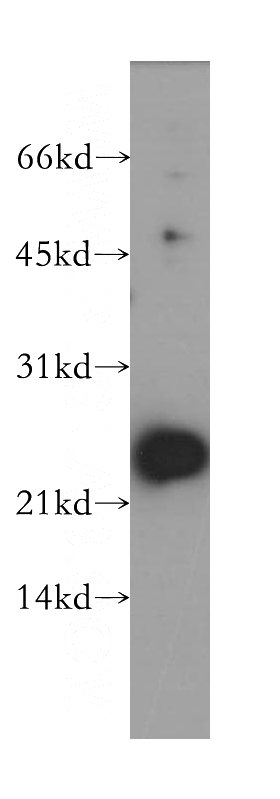 mouse testis tissue were subjected to SDS PAGE followed by western blot with Catalog No:113249(NME5 antibody) at dilution of 1:500