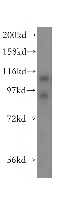 mouse liver tissue were subjected to SDS PAGE followed by western blot with Catalog No:110388(LIMA1 antibody) at dilution of 1:500