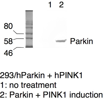 WB result of PINK1 antibody with Transfected 293 cells (courtesy of T. Izumi, PhD, University of Kentucky).