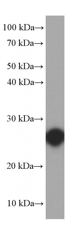 fetal human brain tissue were subjected to SDS PAGE followed by western blot with Catalog No:107507(RND3 Antibody) at dilution of 1:2000