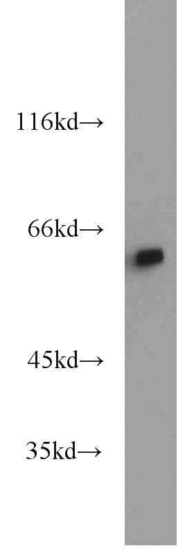 HeLa cells were subjected to SDS PAGE followed by western blot with Catalog No:111567(HSPD1 antibody) at dilution of 1:6000