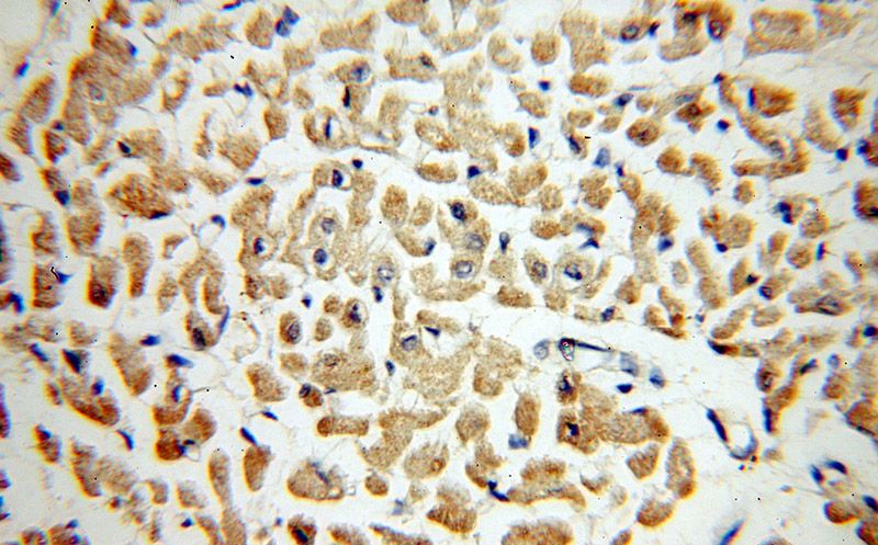 Immunohistochemical of paraffin-embedded human heart using Catalog No:110048(DocK9 antibody) at dilution of 1:100 (under 40x lens)
