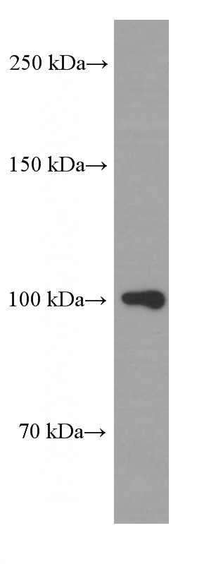 Y79 cells were subjected to SDS PAGE followed by western blot with Catalog No:107584(APP Antibody) at dilution of 1:1000