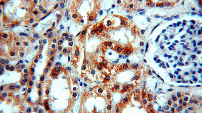 Immunohistochemical of paraffin-embedded human kidney using Catalog No:108966(CCDC158 antibody) at dilution of 1:100 (under 40x lens)