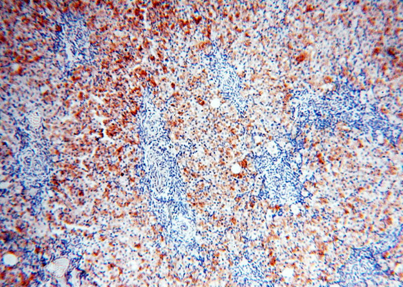 Immunohistochemical of paraffin-embedded human ovary using Catalog No:116994(XPO6 antibody) at dilution of 1:25 (under 10x lens)