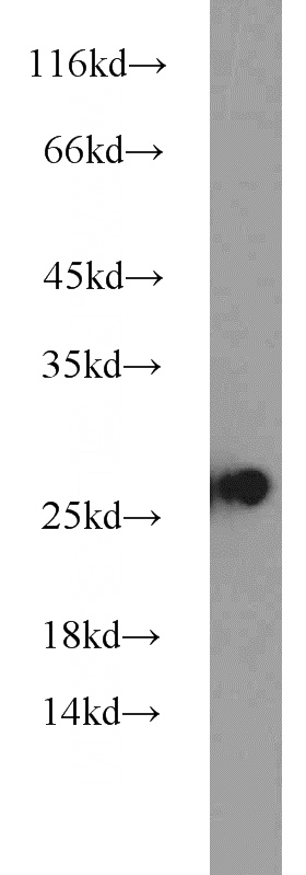 Jurkat cells were subjected to SDS PAGE followed by western blot with Catalog No:111478(HMGB1 antibody) at dilution of 1:1000
