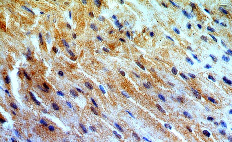 Immunohistochemical of paraffin-embedded human heart using Catalog No:112983(MYO1B antibody) at dilution of 1:50 (under 40x lens)