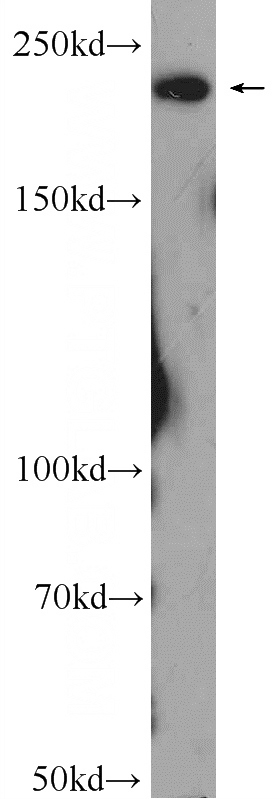 HeLa cells were subjected to SDS PAGE followed by western blot with Catalog No:108293(ATG2A Antibody) at dilution of 1:300