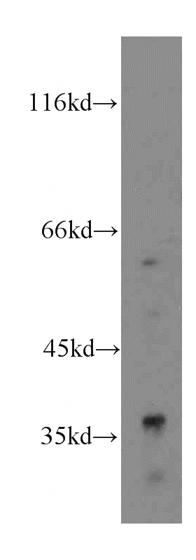 HepG2 cells were subjected to SDS PAGE followed by western blot with Catalog No:111061(GPD1 antibody) at dilution of 1:400