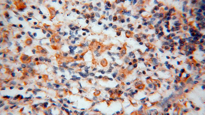 Immunohistochemical of paraffin-embedded human spleen using Catalog No:117140(BHMT antibody) at dilution of 1:100 (under 40x lens)