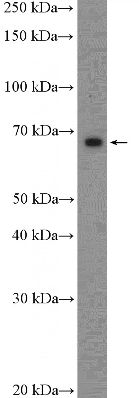 Jurkat cells were subjected to SDS PAGE followed by western blot with Catalog No:111343(HIC2 Antibody) at dilution of 1:300