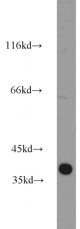 mouse brain tissue were subjected to SDS PAGE followed by western blot with Catalog No:108993(CCDC94 antibody) at dilution of 1:1000