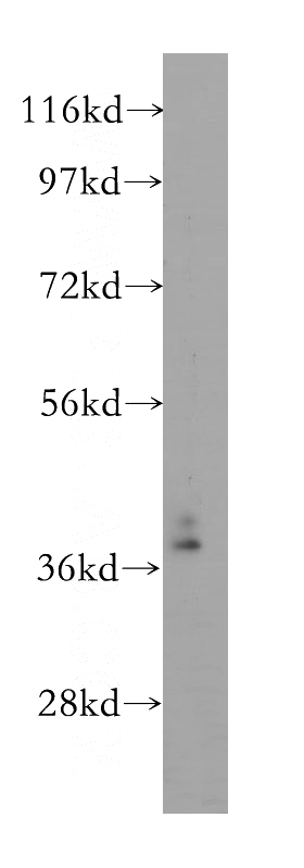 human brain tissue were subjected to SDS PAGE followed by western blot with Catalog No:116003(TFAP4 antibody) at dilution of 1:500
