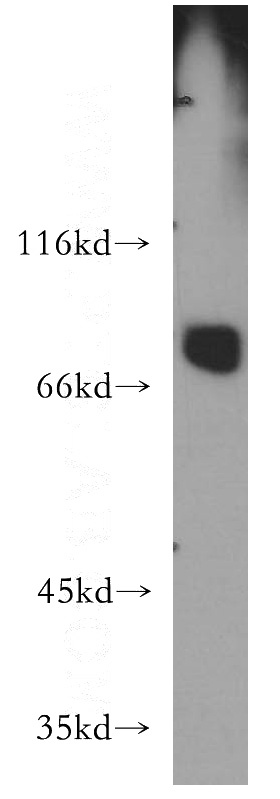 mouse testis tissue were subjected to SDS PAGE followed by western blot with Catalog No:112355(LSS antibody) at dilution of 1:400