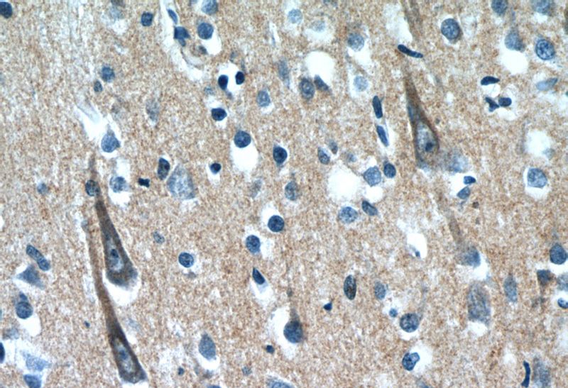 Immunohistochemistry of paraffin-embedded human brain slide using Catalog No:116877(XRN1 Antibody) at dilution of 1:50