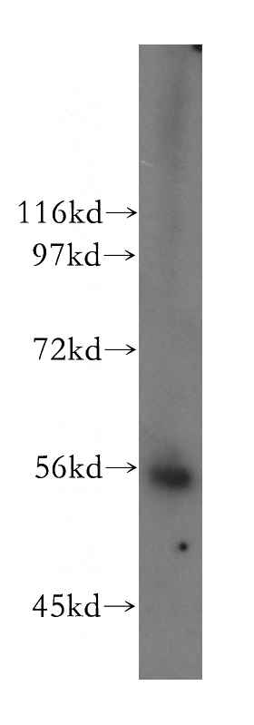 A549 cells were subjected to SDS PAGE followed by western blot with Catalog No:112243(LIPH antibody) at dilution of 1:500