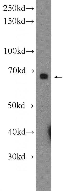 mouse liver tissue were subjected to SDS PAGE followed by western blot with Catalog No:114324(PTPN9 Antibody) at dilution of 1:1000