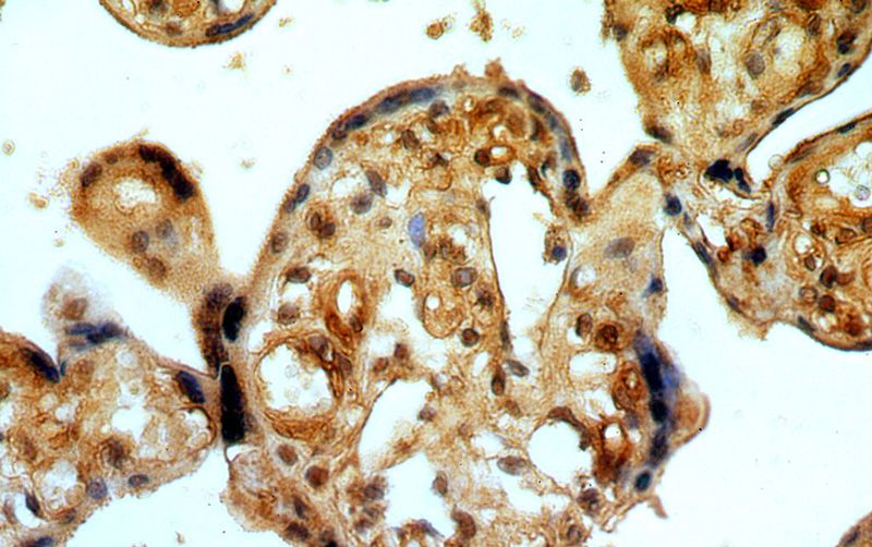 Immunohistochemical of paraffin-embedded human placenta using Catalog No:116882(YBX1 antibody) at dilution of 1:100 (under 40x lens)