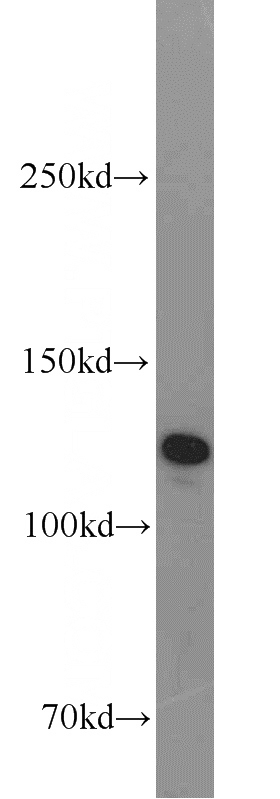 HeLa cells were subjected to SDS PAGE followed by western blot with Catalog No:115078(SEC23IP antibody) at dilution of 1:1000