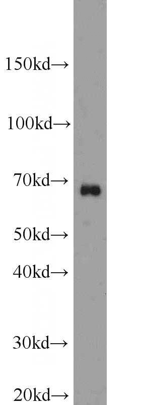 HepG2 cells were subjected to SDS PAGE followed by western blot with Catalog No:115056(SAMHD1 antibody) at dilution of 1:1000