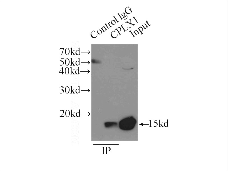 IP Result of anti-CPLX1 (IP:Catalog No:109509, 3ug; Detection:Catalog No:109509 1:200) with mouse brain tissue lysate 6500ug.