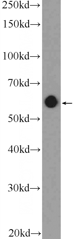 HeLa cells were subjected to SDS PAGE followed by western blot with Catalog No:113109(NELF-A Antibody) at dilution of 1:1000