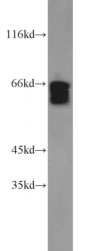 K-562 cells were subjected to SDS PAGE followed by western blot with Catalog No:115495(BAG4 antibody) at dilution of 1:1000