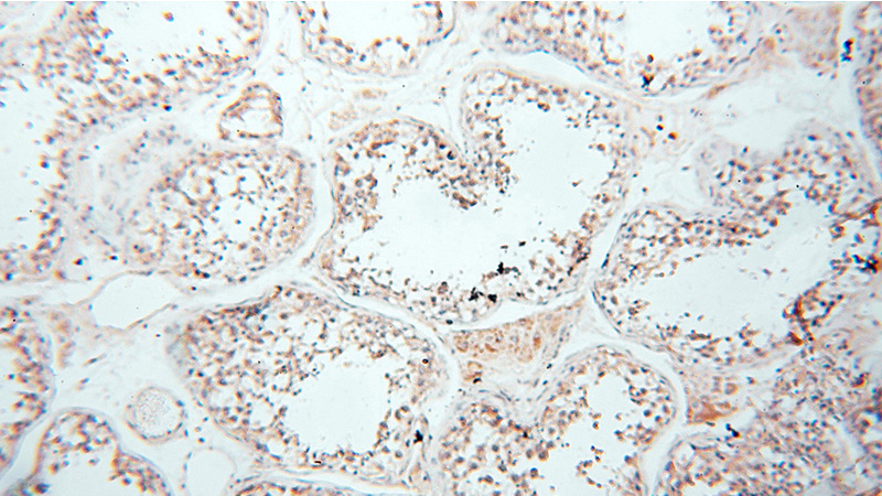 Immunohistochemical of paraffin-embedded human testis using Catalog No:112212(LGR6 antibody) at dilution of 1:50 (under 10x lens)