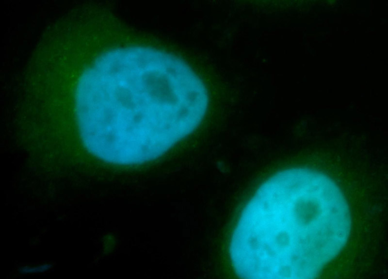 Immunofluorescent analysis of MCF-7 cells, using ACTR1B antibody Catalog No:107715 at 1:50 dilution and FITC-labeled donkey anti-rabbit IgG(green). Blue pseudocolor = DAPI (fluorescent DNA dye).